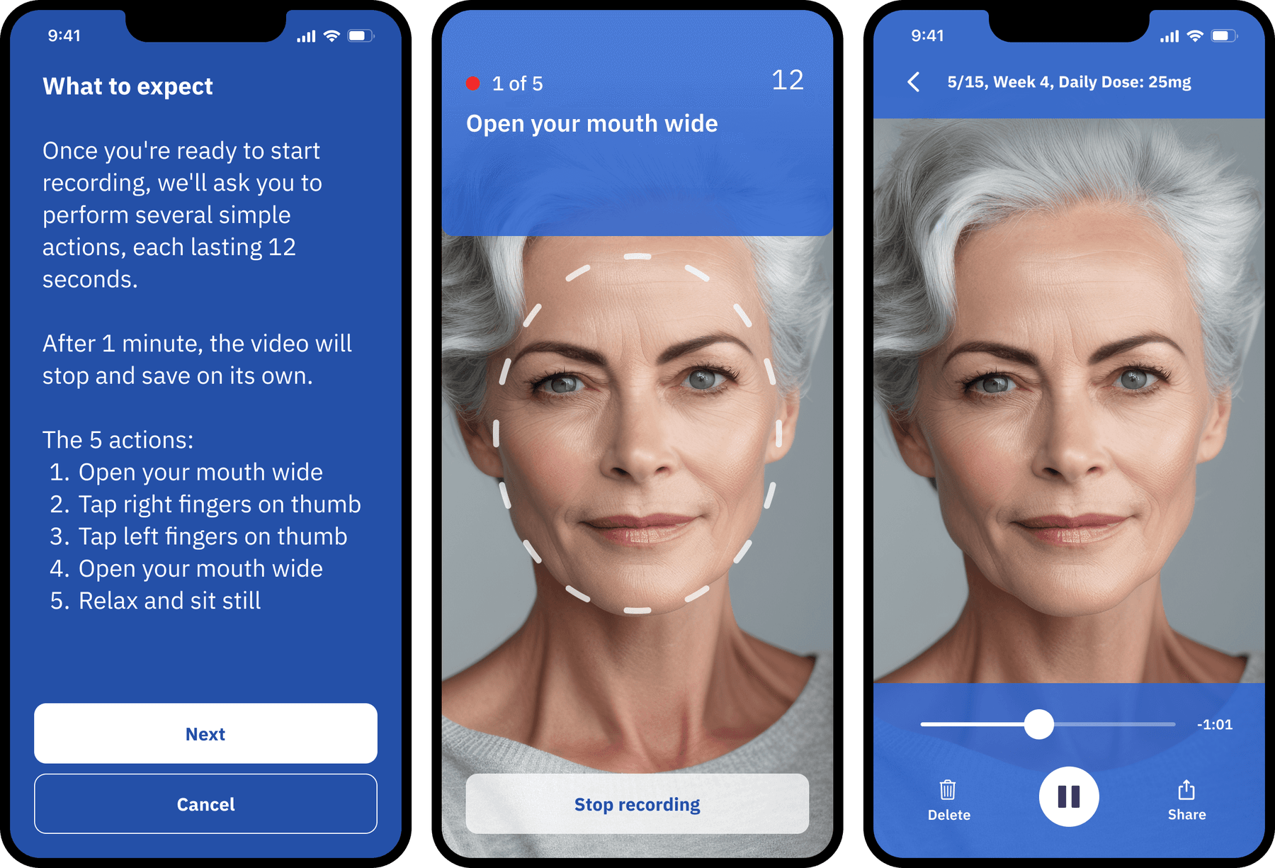 The movement video flow: a 'What to expect' screen listing the five prompted actions, the guided recording view with a face outline and countdown, and playback of a saved video tagged with the week and daily dose.